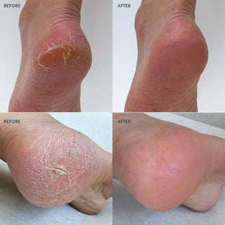 VOESH "Solemate" Heel Repair Balm